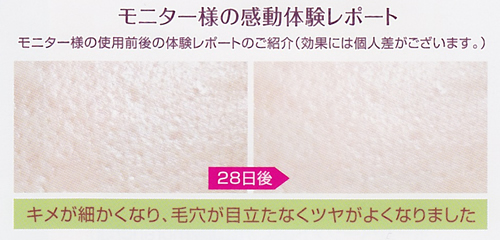 ���j�^�[�l�̊����̌����|�[�g