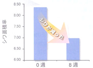 �A���`�G�C�W���O